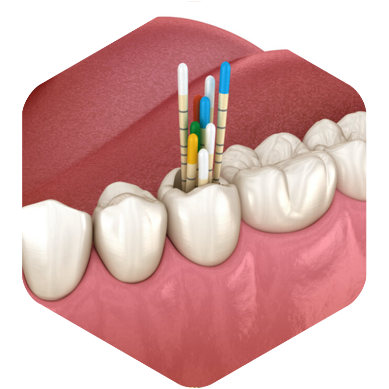 Illustration of dental closeup